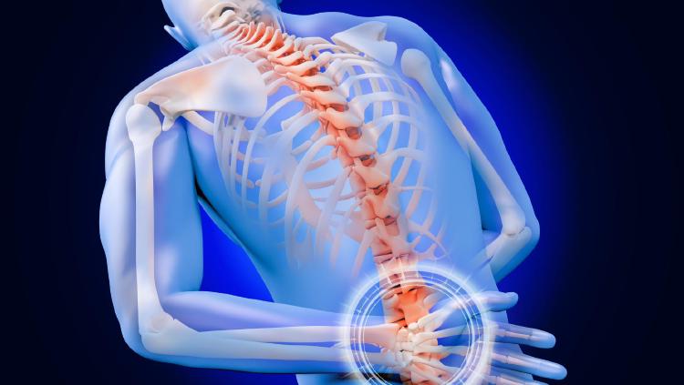 요추염좌 회복기간, 2주 만에 사라진 비밀 대처법